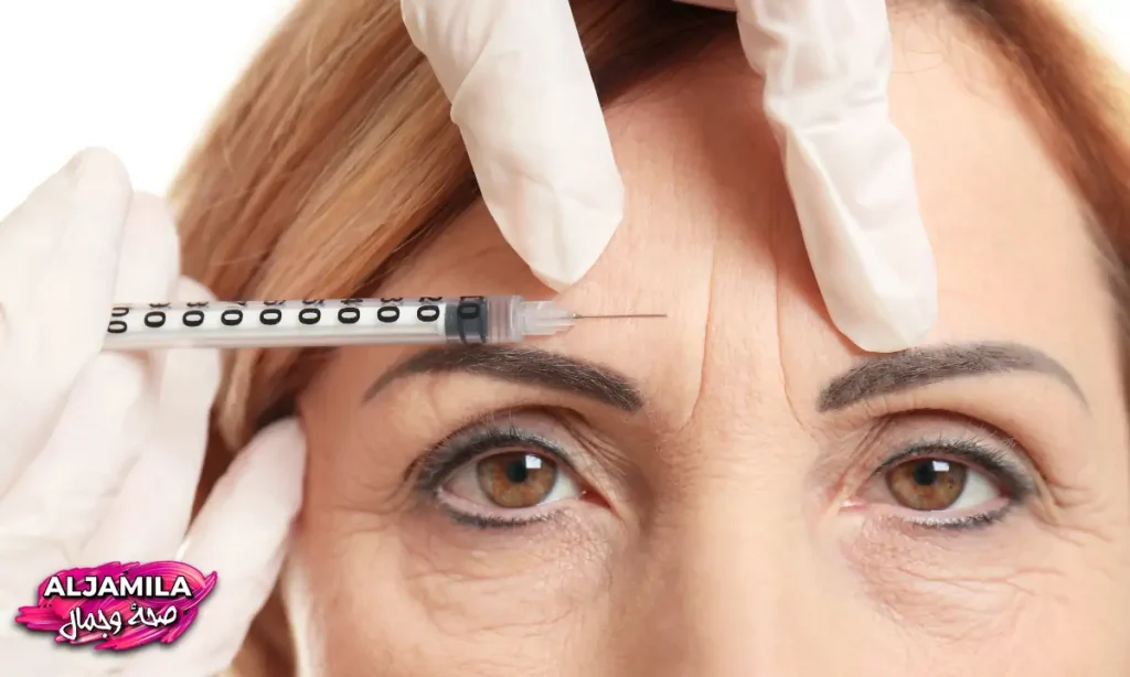 الحقن في خطوط العبوس