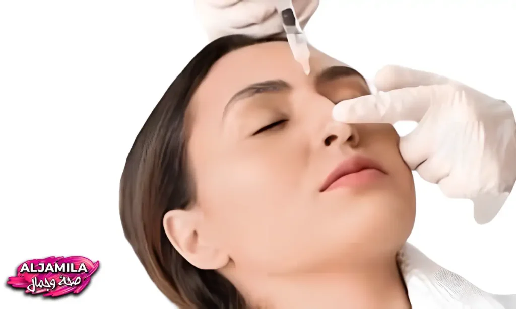 حقن خطوط الأنف