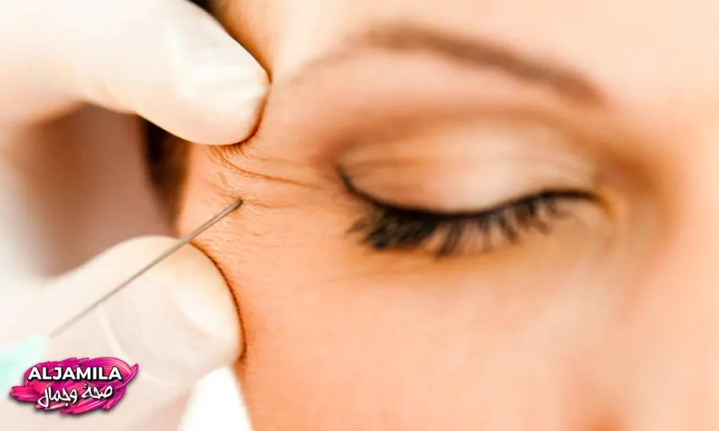 حول العينين