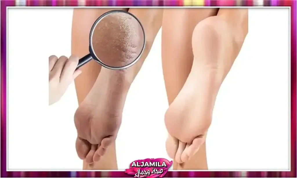 فحص الأقدام بانتظام