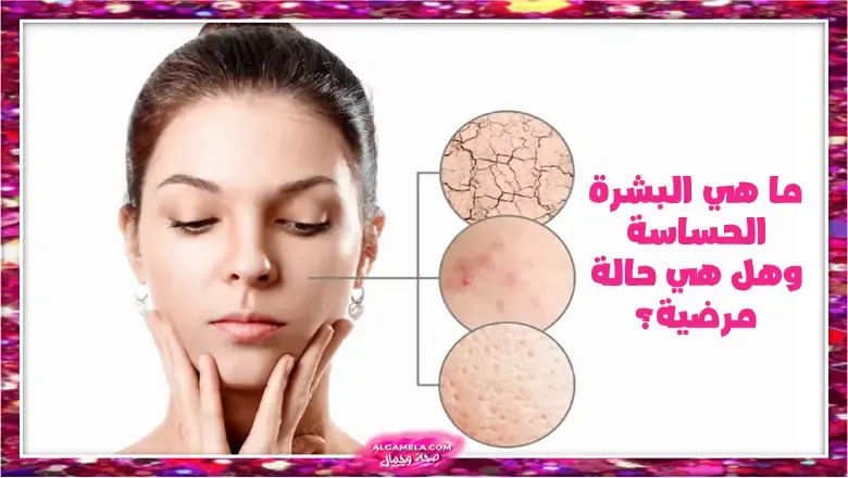 ما هي البشرة الحساسة؟