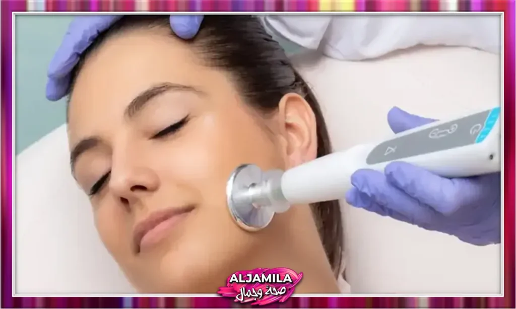تجديد شباب البشرة : جيت بلازما (Jet Plasma)