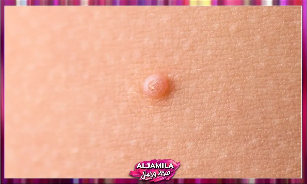 العقيدات Nodules