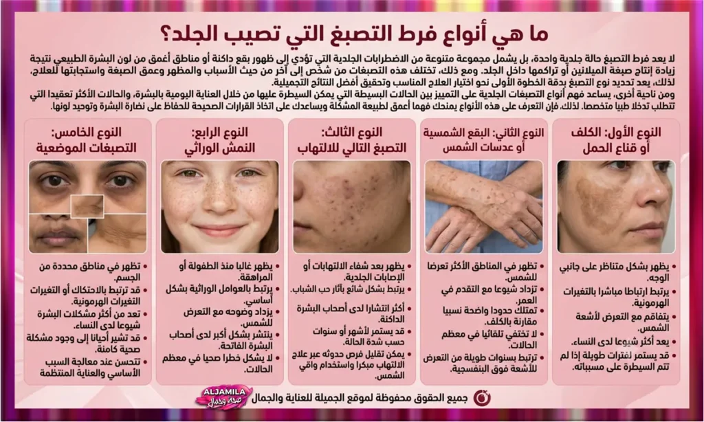 ما هي أنواع فرط التصبغ التي تصيب الجلد؟